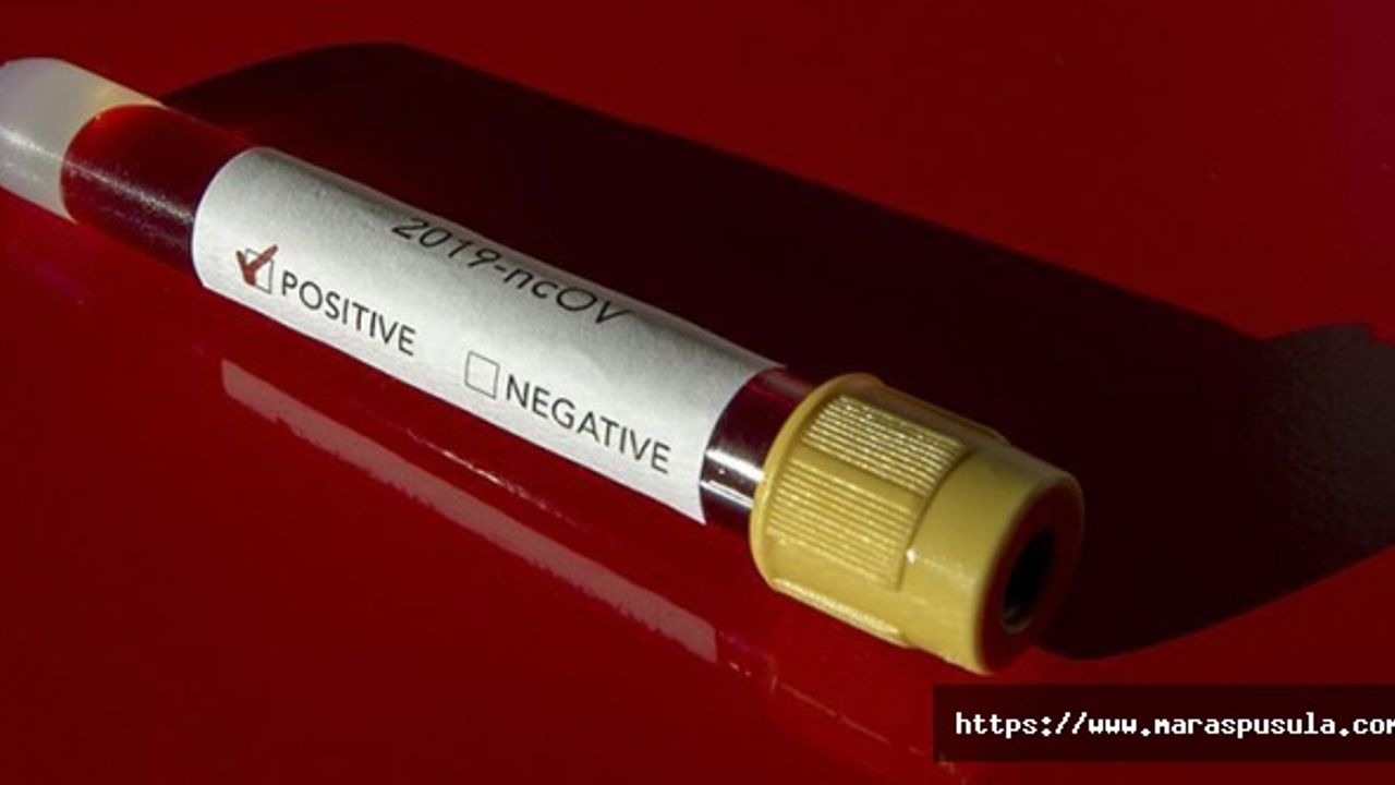 28 yaşındaki Türk kadın koronavirüsten yaşamını yitirdi