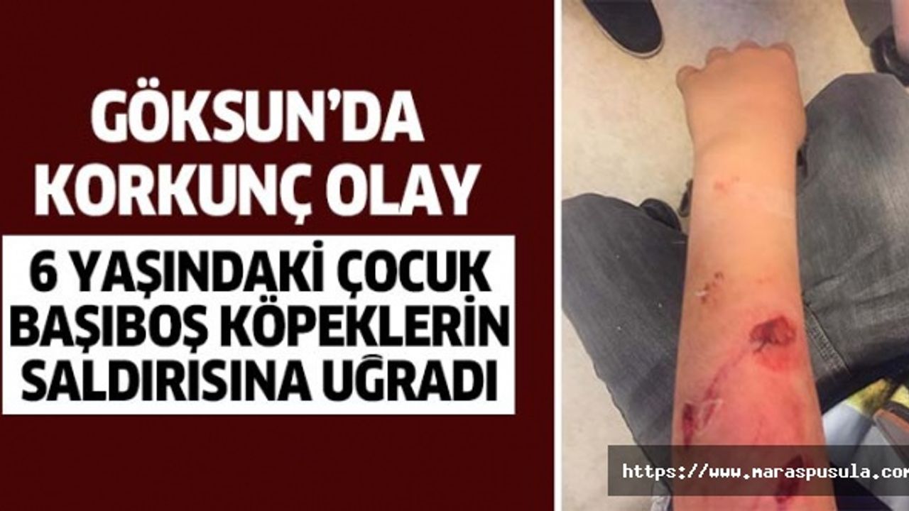 Göksun’da başıboş köpekler 6 yaşındaki çocuğa saldırdı