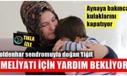Kahramanmaraş’ta Goldenhar Sendromuyla doğan Yiğit, ameliyatı için yardım bekliyor!