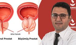 Küçükdurmaz, İyi Huylu Prostat Büyümesi Yaşam Kalitesini Düşürüyor