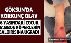 Göksun’da başıboş köpekler 6 yaşındaki çocuğa saldırdı
