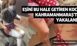 Eşini bu hale getiren koca Kahramanmaraş’ta yakalandı