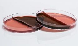 Medexia: Mikrobiyoloji ve Biyoteknolojiye Yüksek Kaliteli Besiyeri Çözümleri