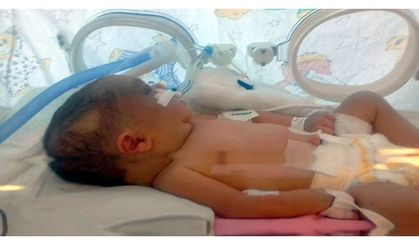 Kafatası Çatlayan 6 Günlük Bebek, Yaşam Savaşı Veriyor