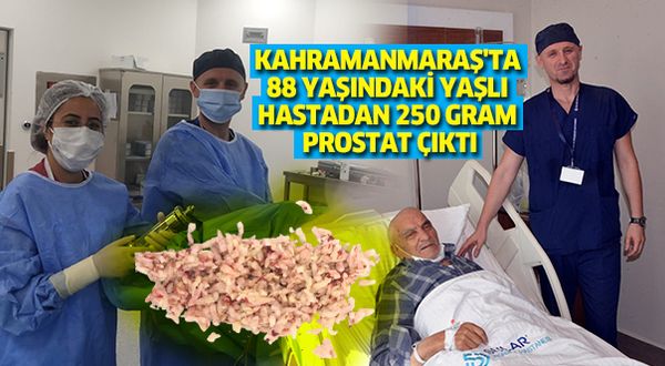 Kahramanmaraş'ta 88 yaşındaki hastadan 250 grm prostat çıktı
