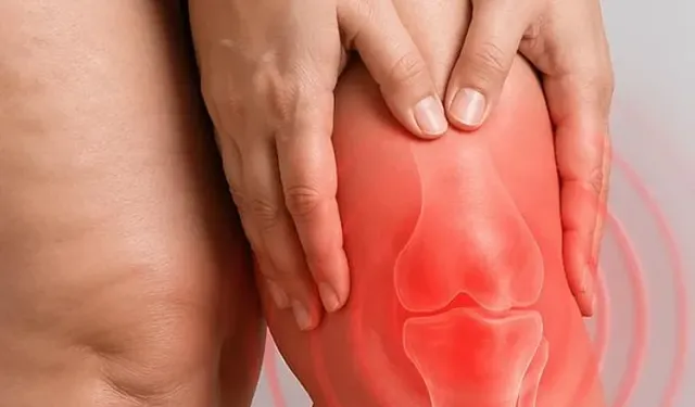 Diz biyomekaniğini bozan süreç: Lipödem