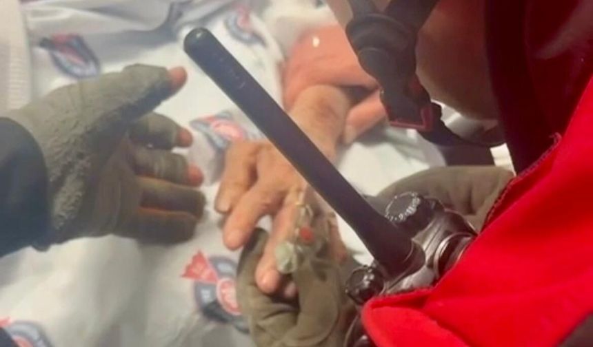 Kahramanmaraş'ta parmağa sıkışan yüzüğü itfaiye çıkardı!