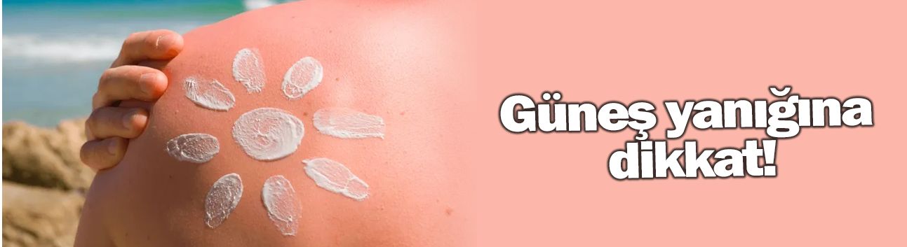 Güneş yanığına dikkat!