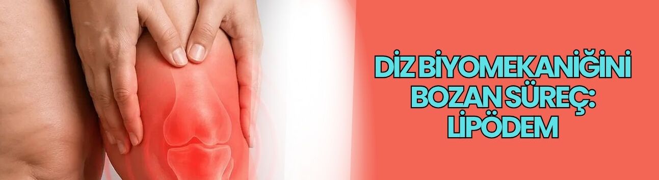 Diz biyomekaniğini bozan süreç: Lipödem